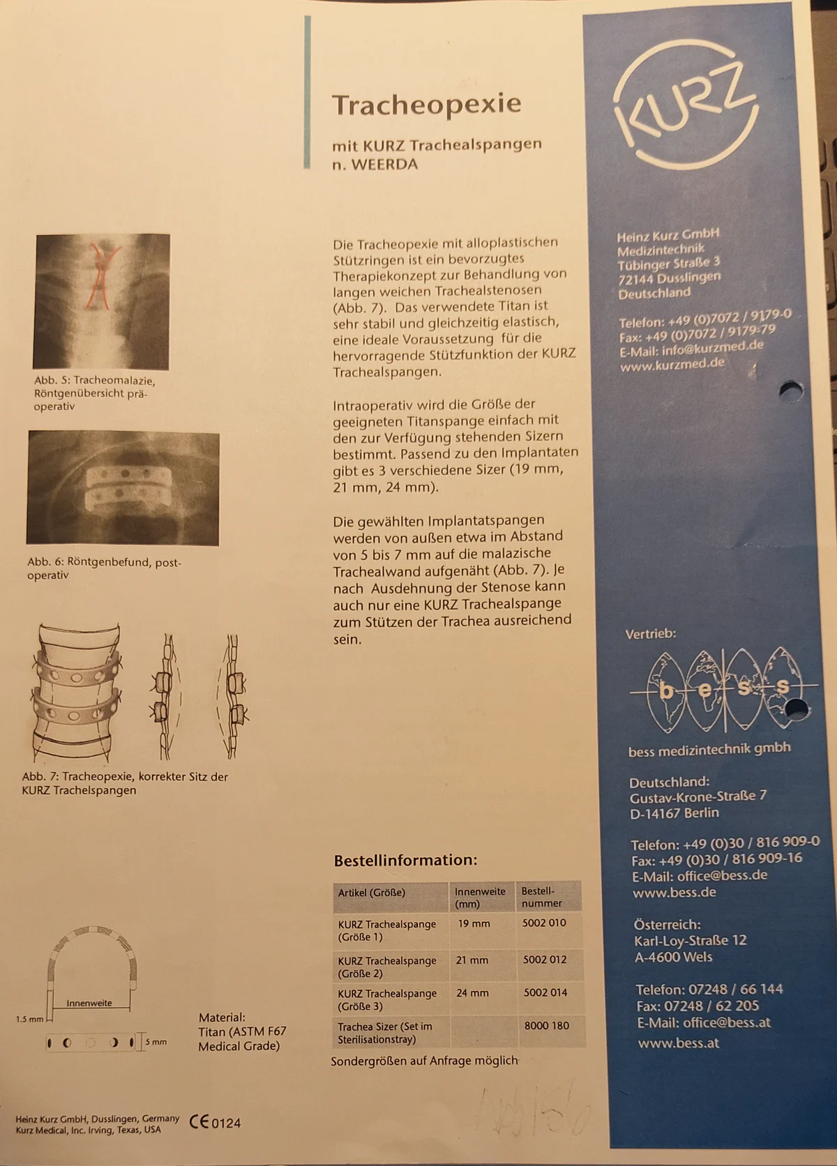 Technische Dokumentation zur Tracheopexie mit schematischer Darstellung der Stützringe.