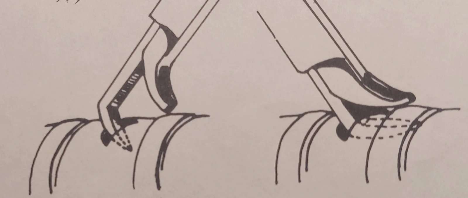 Zeichnung zur Anwendung der Tracheotomie-Stanze.